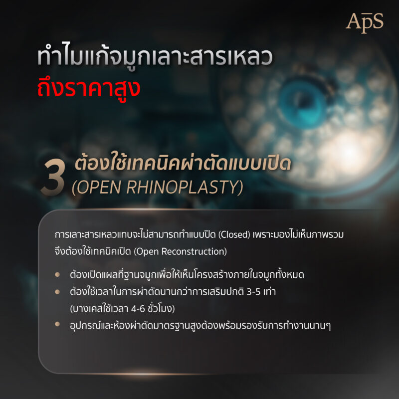 ทำไมแก้จมูกเลาะสารเหลว ถึงราคาสูง