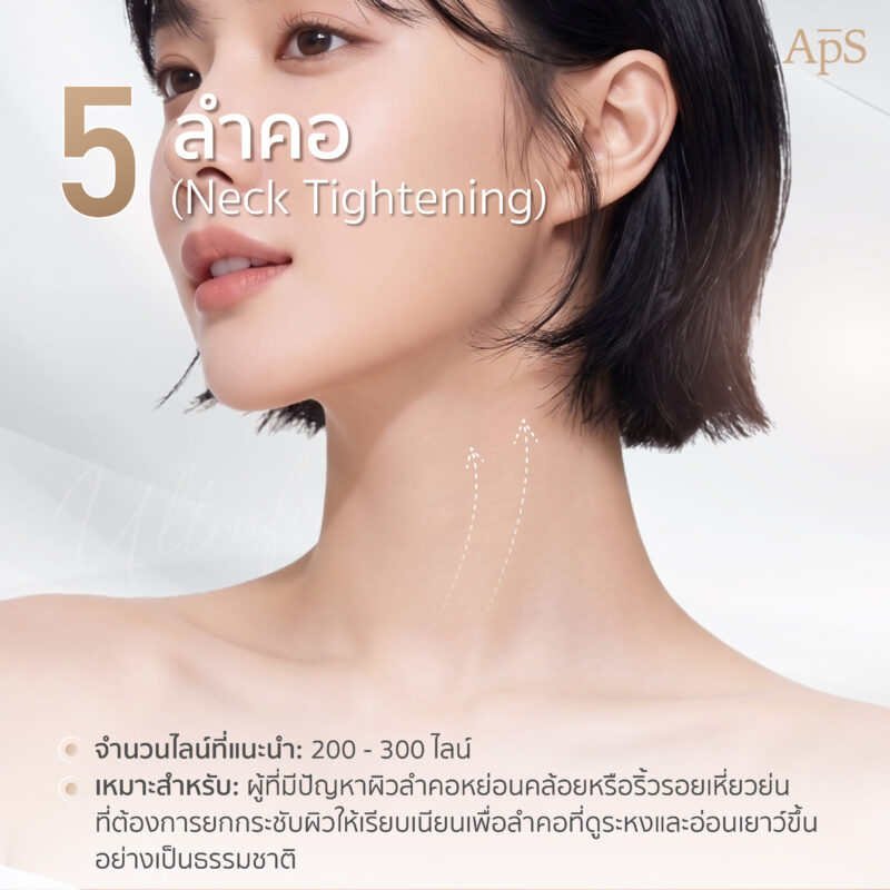 โปรแกรม Ultraformer III ยกกระชับลำคอ