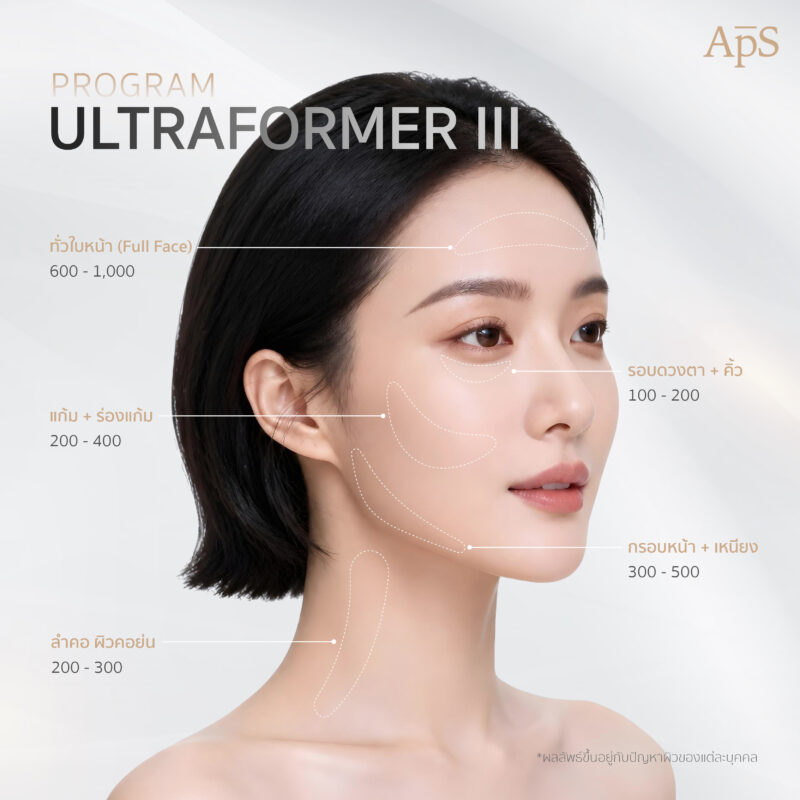 โปรแกรม Ultraformer III ยกกระชับ
