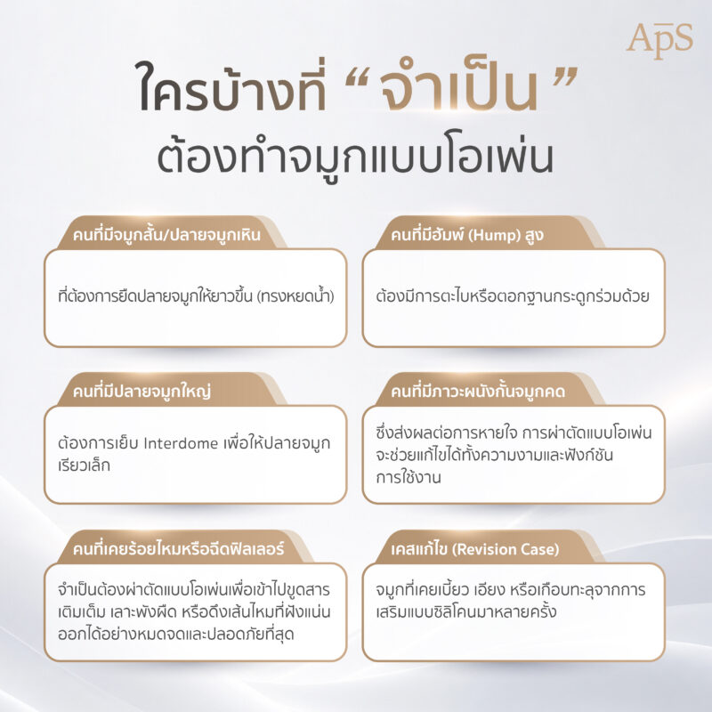 ทำไมการทำจมูกแบบโอเพ่นถึงมีราคาแพง ดีคุ้มค่าแก่การลงทุนไหม 4 ใครบ้างที่ต้องทำจมูกแบบโอเพ่น