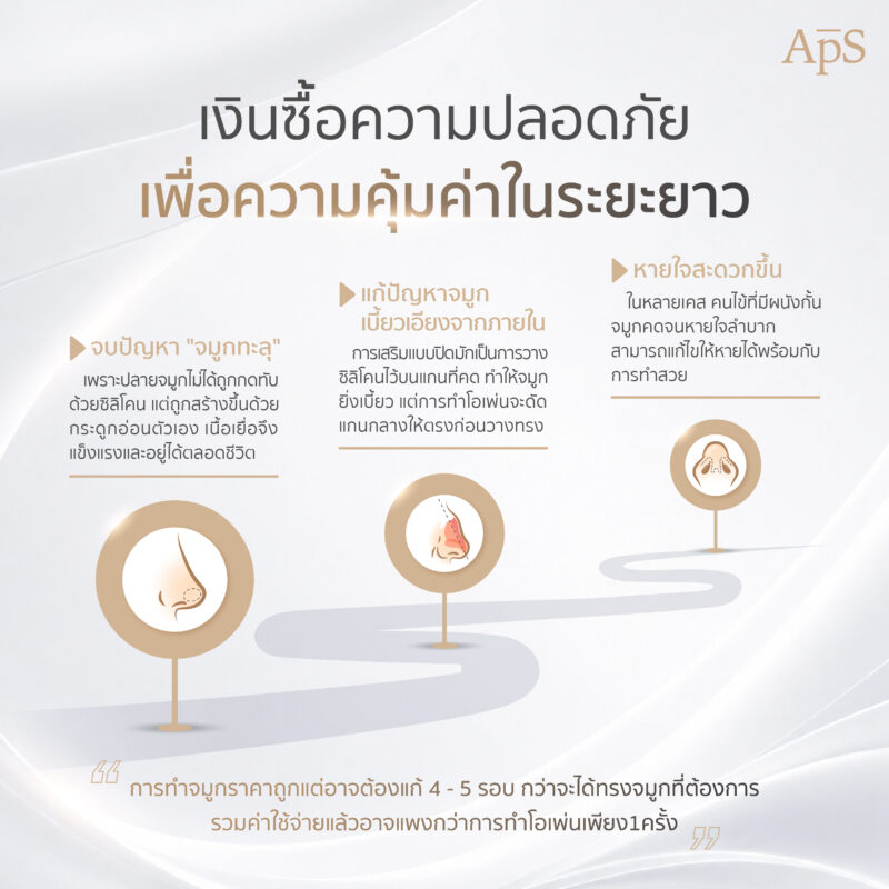 ทำไมการทำจมูกแบบโอเพ่นถึงมีราคาแพง ดีคุ้มค่าแก่การลงทุนไหม 5 การทำจมูกแบบโอเพ่น เรียบเทียบได้กับการซื้อความปลอดภัยคุ้มค่าในระยะยาว