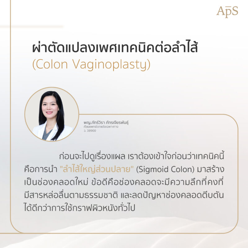 ผ่าตัดแปลงเพศเทคนิคต่อลำไส้