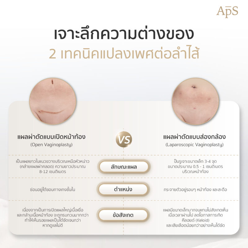 ความแตกต่างของเทคนิคผ่าตัดแปลงเพศเทคนิคต่อลำไส้