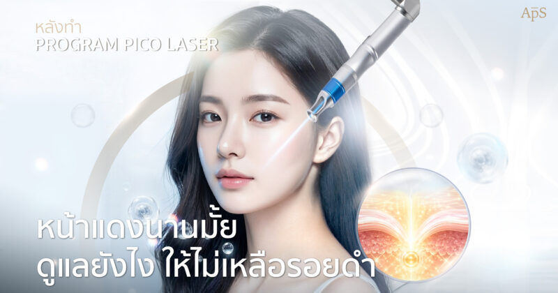 หน้าแดงหลังทำโปรแกรม Pico Laser
