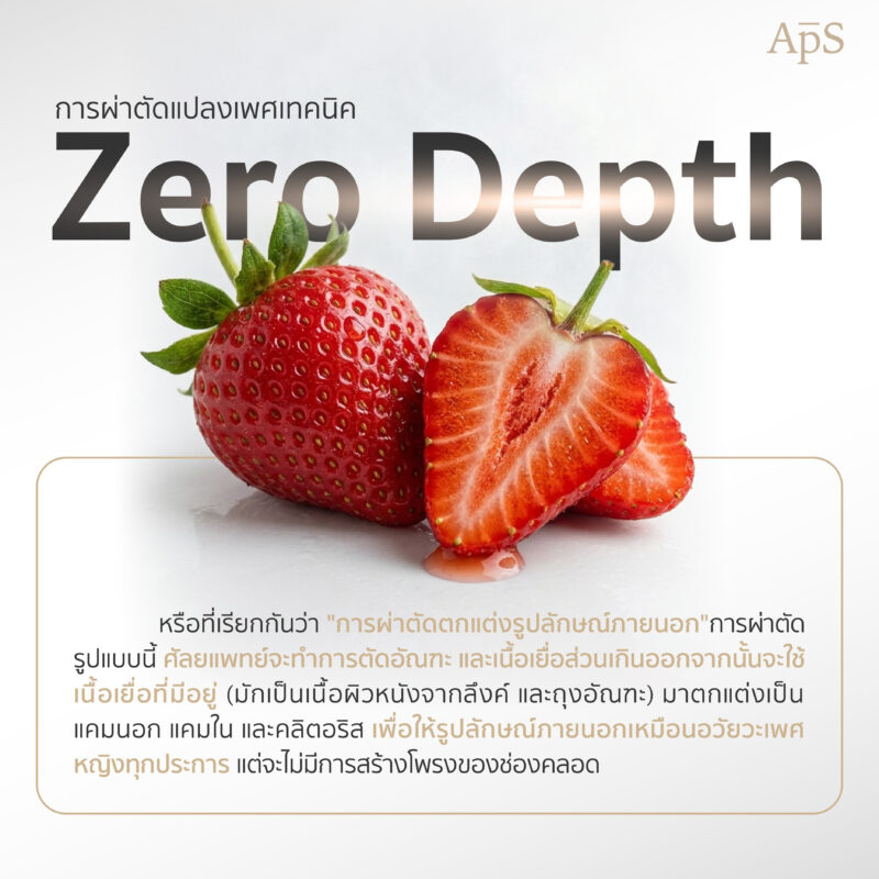 เทคนิค Zero Depth คืออะไร และทำไมหลายคนถึงเลือกวิธีนี้