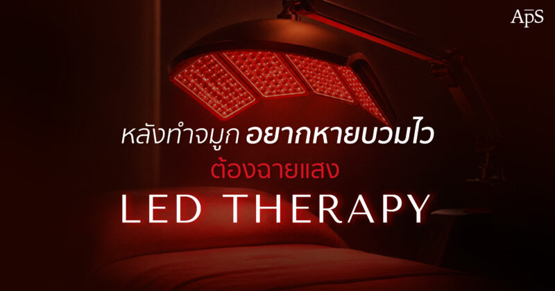 ฉายแสงหลังทำจมูก
