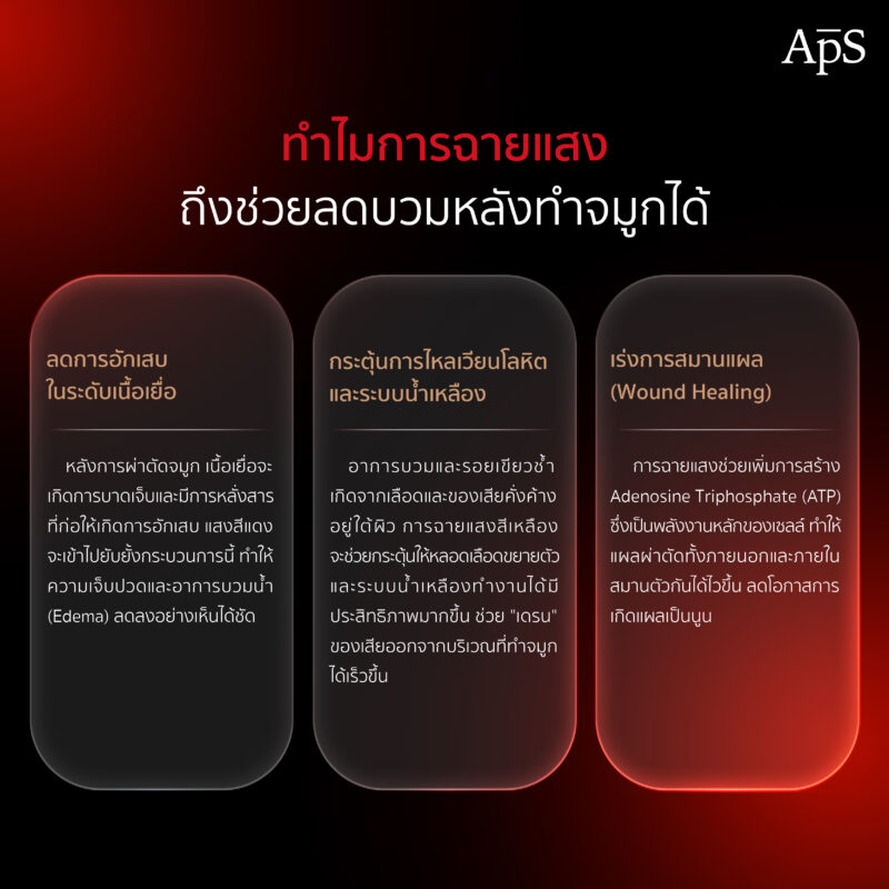 ฉายแสงหลังทำจมูกช่วยลดบวมได้จริงหรอ หลักการทำงานต่ออาการบวมหลังทำจมูก 3 ทำไมการฉายแสงถึงช่วยลดบวมได้