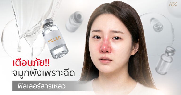 อันตรายจากการทำโปรแกรมฉีดฟิลเลอร์และสารเหลวที่จมูก