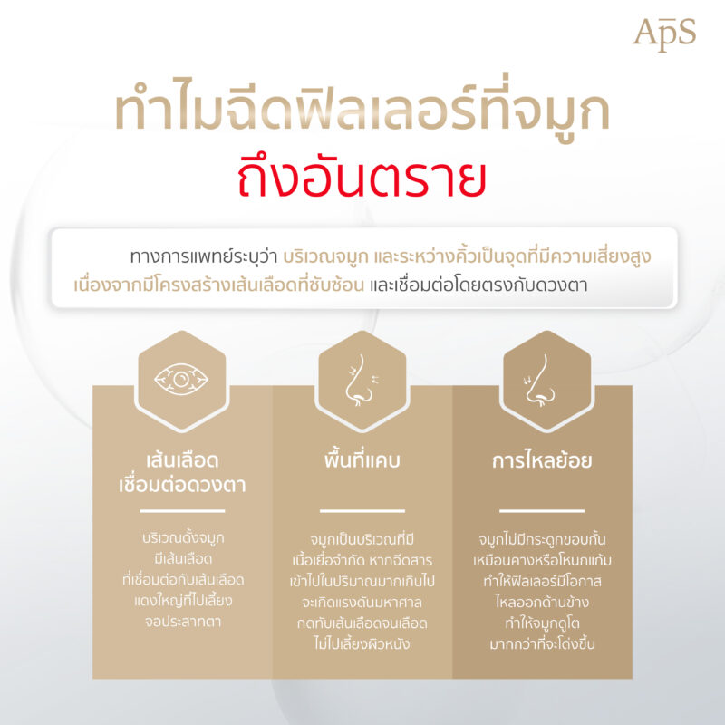 อันตรายจากการทำโปรแกรมฉีดฟิลเลอร์และสารเหลวที่จมูก ความสวยที่ต้องแลกด้วยความเสี่ยง 2 ทำไมการทำโปรแกรมฉีดฟิลเลอร์จมูกถึงอันตรายกว่าบริเวณอื่น?