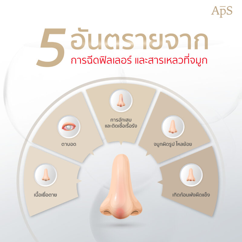 อันตรายจากการทำโปรแกรมฉีดฟิลเลอร์และสารเหลวที่จมูก ความสวยที่ต้องแลกด้วยความเสี่ยง 3 อันตรายร้ายแรงและผลกระทบจากการฉีดสารเหลวที่จมูก