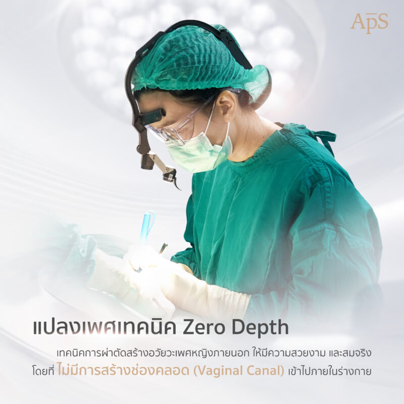 การแยงโมลด์หลังแปลงเพศ คืออะไร? ทำไมหลายคนถึงกังวล
