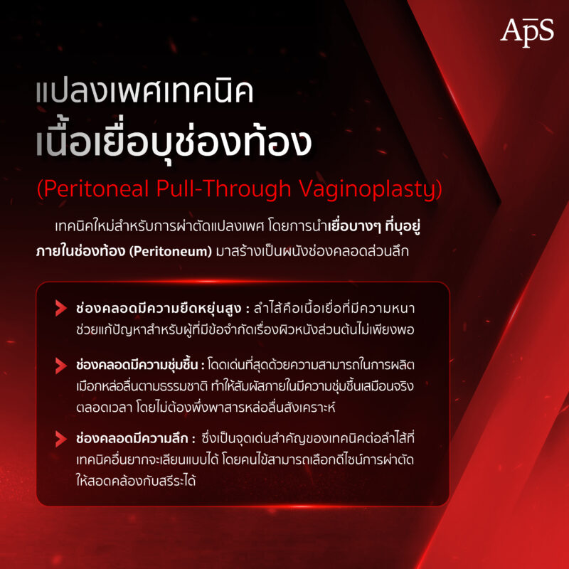 แปลงเพศเทคนิคต่อลำไส้กับ PPV ต่างกันอย่างไร? ควรเลือกแปลงเพศเทคนิคไหน 3 เทคนิค PPV คืออะไร?