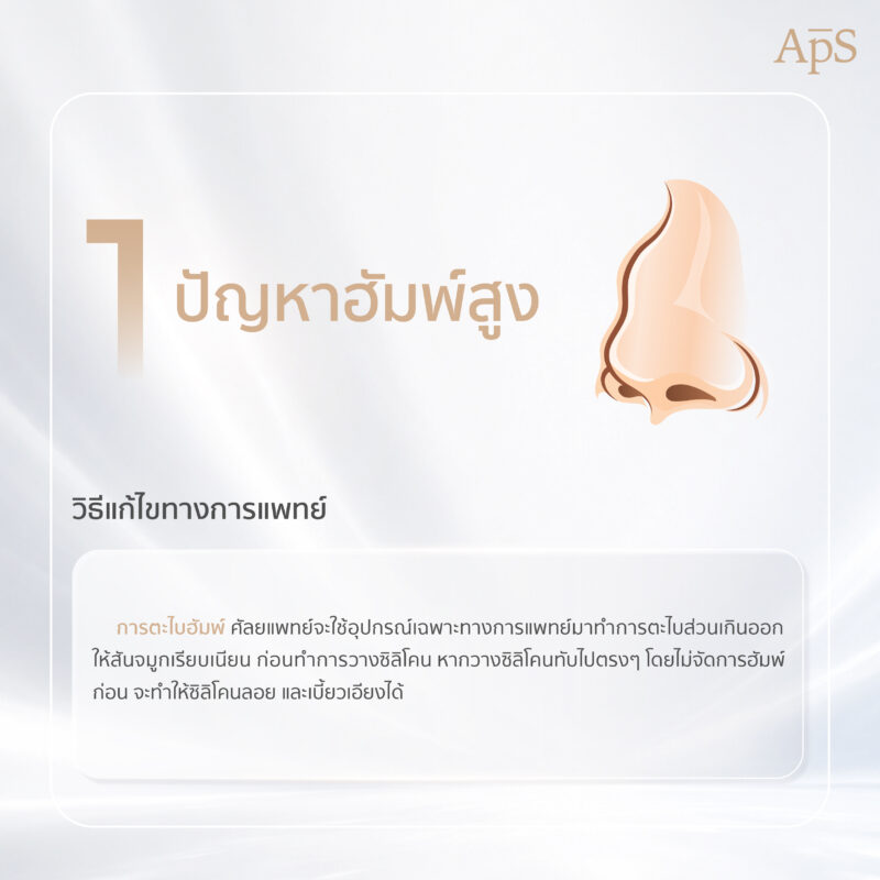 ปัญหาฮัมพ์สูง