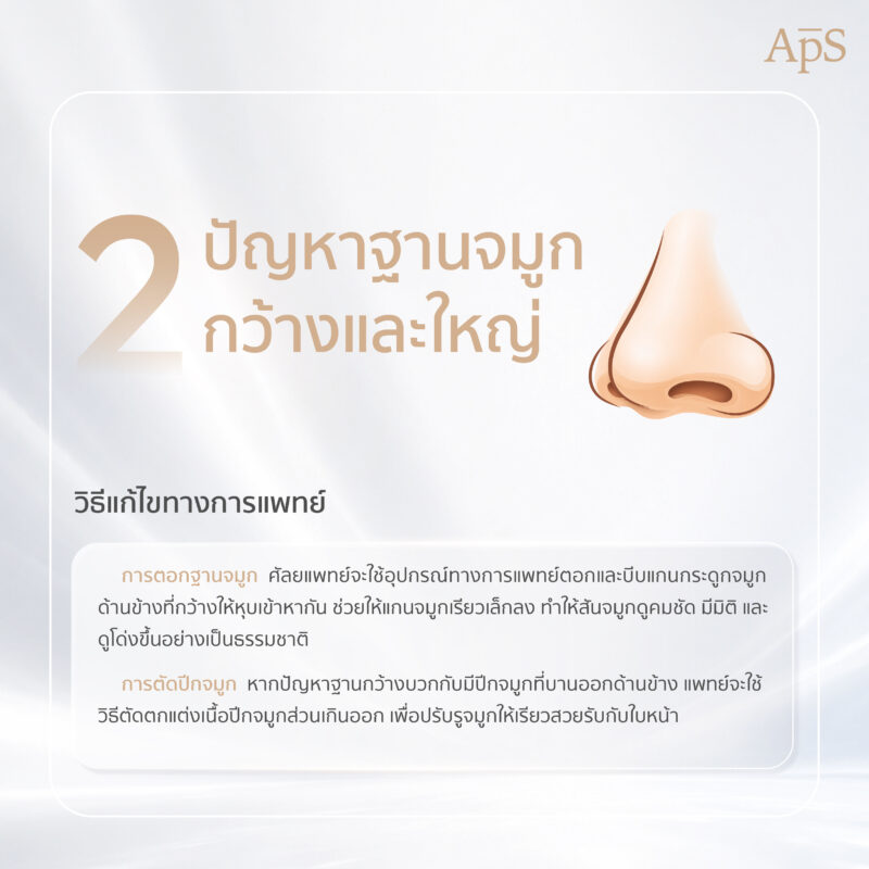 ปัญหาฐานจมูกกว้างและใหญ่