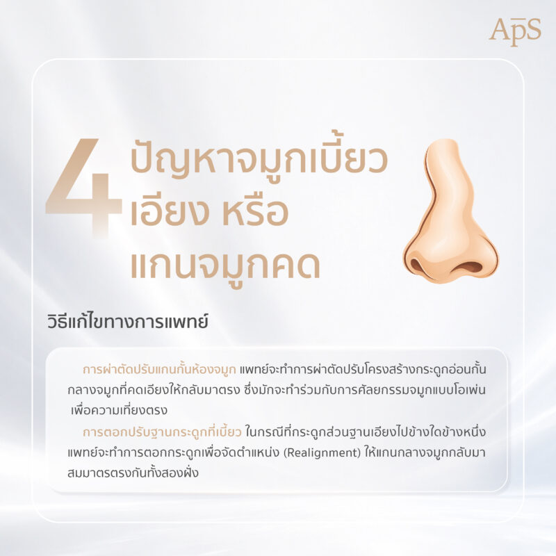 ปัญหาจมูกเบี้ยว เอียงหรือแกนจมูกคด