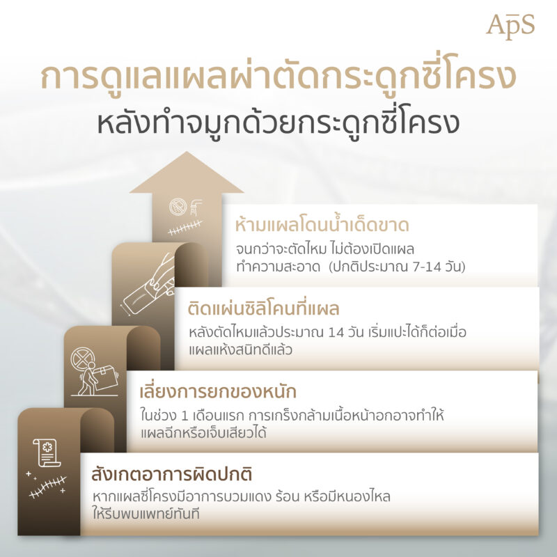 การดูแลตัวเองแผลหลังเสริมจมูกซี่โครง