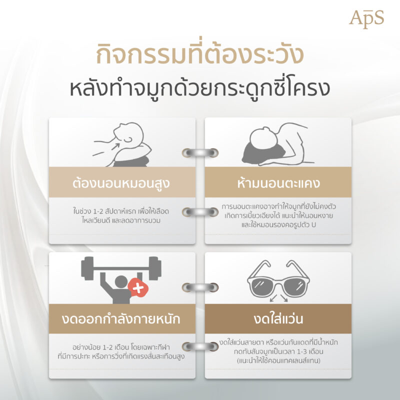 กิจกรรมที่ควรทำหลังเสริมจมูกซี่โครง