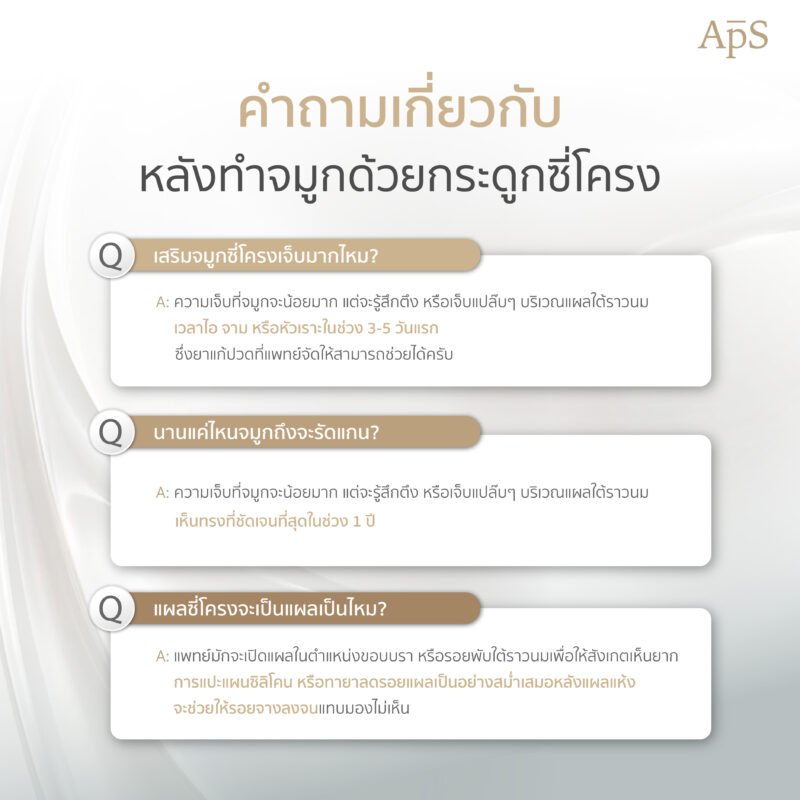 คำถามเกี่ยวกับการเสริมจมูกซี่โครง