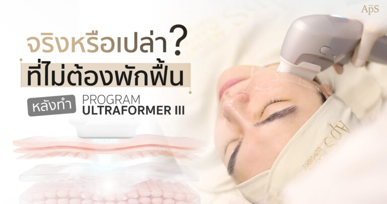 หลังทำโปรแกรม Ultraformer III ต้องพักฟื้นไหม