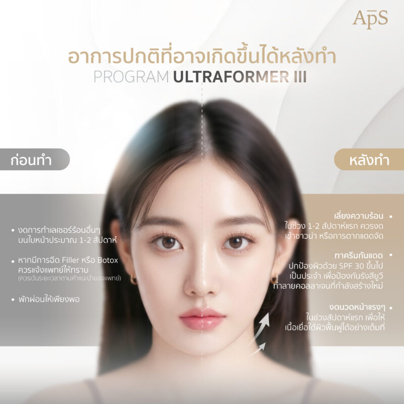 อาการปกติหลังทำหลังทำโปรแกรม Ultraformer III 