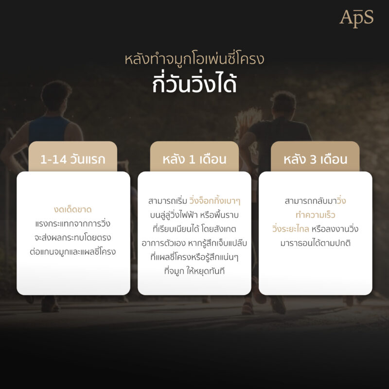ออกกำลังกายหลังทำจมูก เสี่ยงจมูกเบี้ยว เอียง หรืออักเสบจริงไหม? รู้ลึกก่อนพลาด 3 หลังทำจมูกโอเพ่นซี่โครงกี่วันวิ่งได้