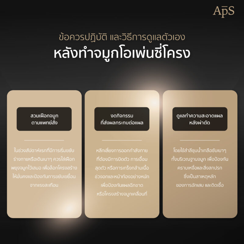 ออกกำลังกายหลังทำจมูก เสี่ยงจมูกเบี้ยว เอียง หรืออักเสบจริงไหม? รู้ลึกก่อนพลาด 6 การดูแลตัวเองหลังทำจมูกโอเพ่นซี๋โครง