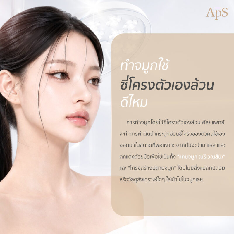 ซี่โครงล้วนหรือซี่โครงร่วมกับซิลิโคน แบบไหนดีกว่ากัน? 4 เสริมจมูกซี่โครงล้วน ดีไหม