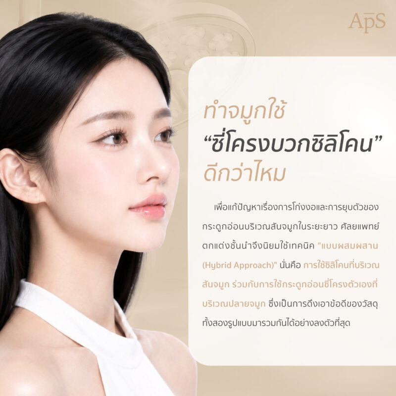 ซี่โครงล้วนหรือซี่โครงร่วมกับซิลิโคน แบบไหนดีกว่ากัน? 5 เสริมจมูกซี่โครงร่วมกับซิลิโคน คืออะไร?