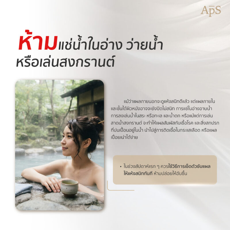 กิจกรรมที่ห้ามทำหลังแปลงเพศ มีอะไรบ้าง? รวมข้อห้ามสำคัญเพื่อการฟื้นตัวที่ดี 8 ห้ามแช่น้ำ หรือว่ายน้ำ