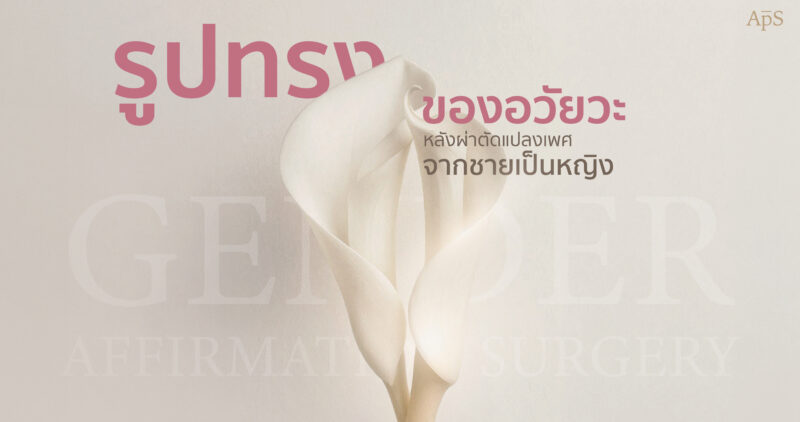 รูปทรงอวัยวะเพศหญิงที่ถูกต้องของการแปลงเพศควรเป็นแบบไหน?