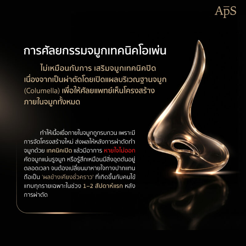 ทำจมูกโอเพ่น