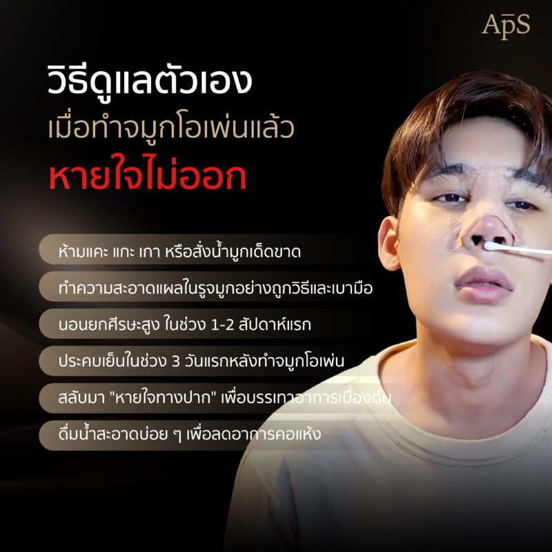 วิธีดูแลตัวเองเมื่อทำจมูกแล้วหายใจไม่ออก