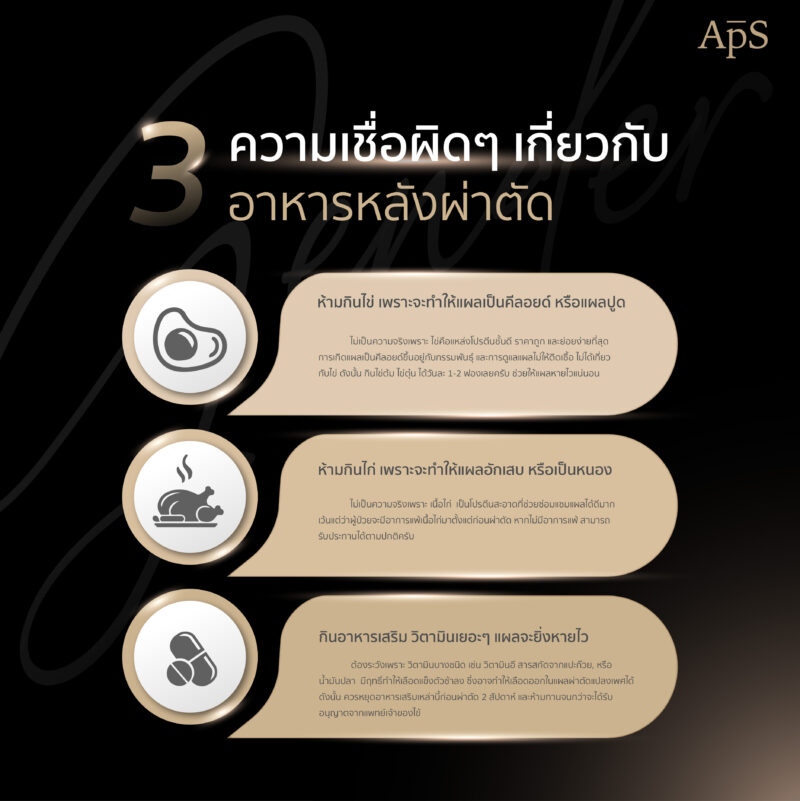 ความเชื่อผิดๆเกี่ยวกับการผ่าตัด