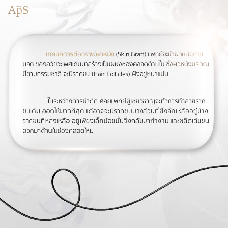 ปัญหาเรื่องขนหลังแปลงเพศต่อกราฟ ขนขึ้นได้ไหม? สิ่งที่ควรรู้ก่อนผ่าตัด 1 แปลงเพศต่อกราฟคืออะไร?