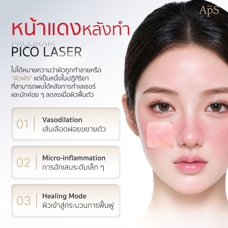 อาการหน้าแดงหลังโปรแกรม Pico Laser คืออะไร? อันตรายไหม หรือแค่เรื่องปกติ