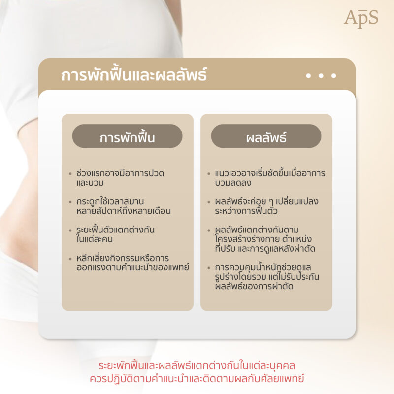 ดัดซี่โครงคืออะไร? ทำความรู้จัก Rib Modeling หัตถการปรับรูปทรงเอวและชายโครง 3 การพักฟื้นและผลลัพธ์