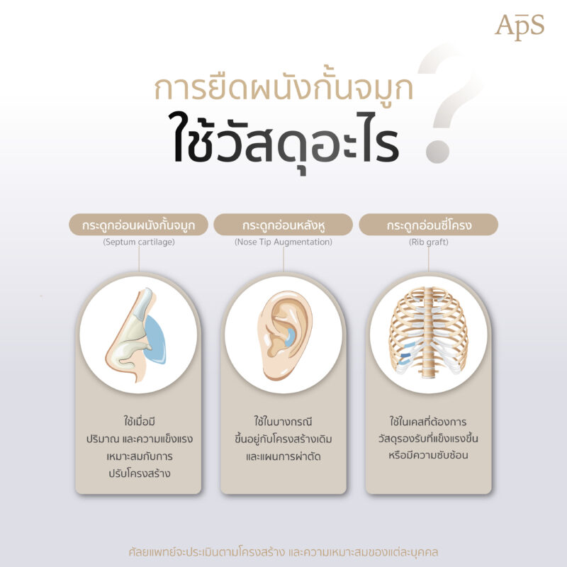 การยืดผนังกั้นจมูกคืออะไร ดีต่อการเสริมจมูกอย่างไร ผลลัพธ์เป็นอย่างไร 4 วัสดุที่ใช้ในการยืดผนังกั้นจมูก