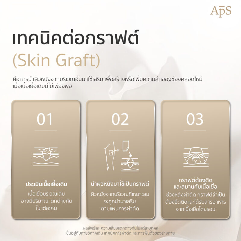 เทคนิคต่อกราฟิกในรูปแบบต่างๆ?