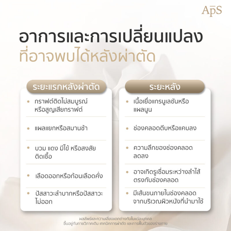 ขั้นตอนการดำเนินการแปลงเทคนิคเทคนิคต่อกราฟิกนั้น